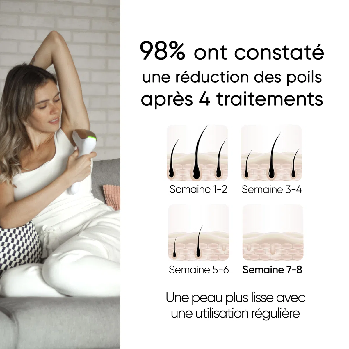 Sensica Sensilight PRO Épilateur à Lumière Pulsée IPL Sans Fil pour Femme & Homme, Épilation à Domicile, Fenêtre XL Corps, Fenêtre de Précision Visage, Mode Glisse Auto, 6 Niveaux d’Énergie